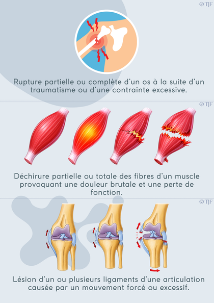 Prévention risques pros  : 180 Aimants ludopédagogiques - Pack 10-en-1